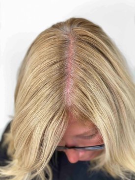 root smudge before